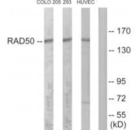 Western blot - RAD50 Antibody from Signalway Antibody (34297) - Antibodies.com