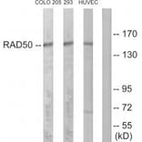 Western blot - RAD50 Antibody from Signalway Antibody (34297) - Antibodies.com