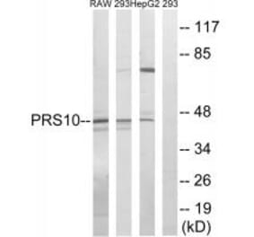 Western blot - PSMC6 Antibody from Signalway Antibody (34306) - Antibodies.com