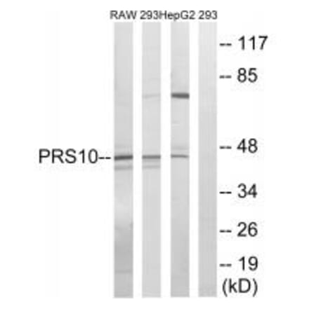 Western blot - PSMC6 Antibody from Signalway Antibody (34306) - Antibodies.com