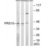 Western blot - PSMC6 Antibody from Signalway Antibody (34306) - Antibodies.com