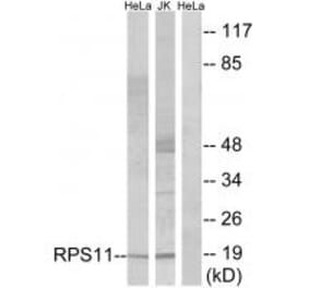 Western blot - RPS11 Antibody from Signalway Antibody (34328) - Antibodies.com