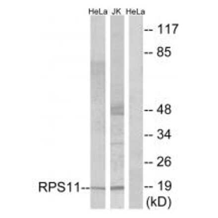 Western blot - RPS11 Antibody from Signalway Antibody (34328) - Antibodies.com