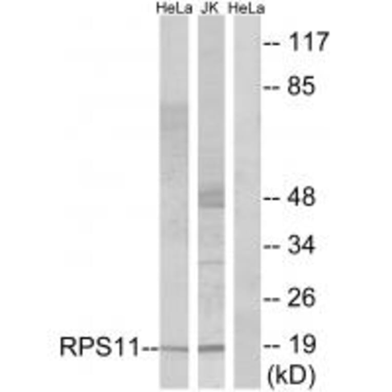 Western blot - RPS11 Antibody from Signalway Antibody (34328) - Antibodies.com
