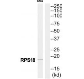 Western blot - RPS18 Antibody from Signalway Antibody (34331) - Antibodies.com