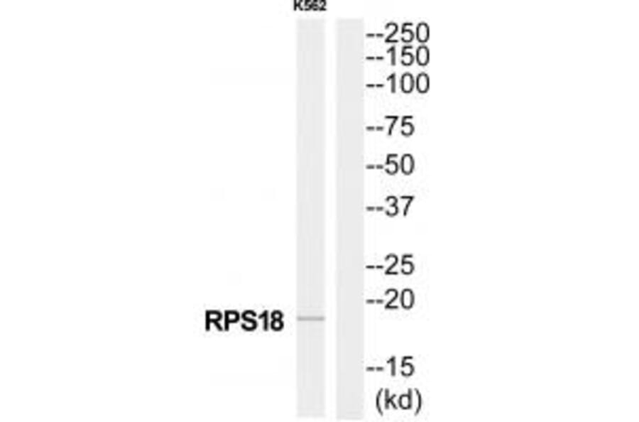 Western blot - RPS18 Antibody from Signalway Antibody (34331) - Antibodies.com