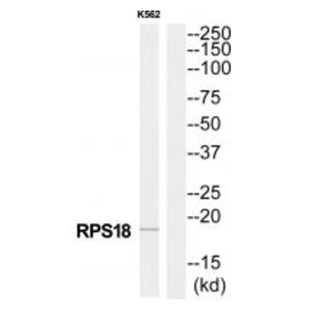 Western blot - RPS18 Antibody from Signalway Antibody (34331) - Antibodies.com