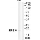 Western blot - RPS18 Antibody from Signalway Antibody (34331) - Antibodies.com