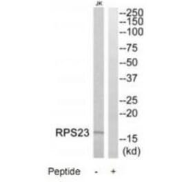 Western blot - RPS23 Antibody from Signalway Antibody (34336) - Antibodies.com
