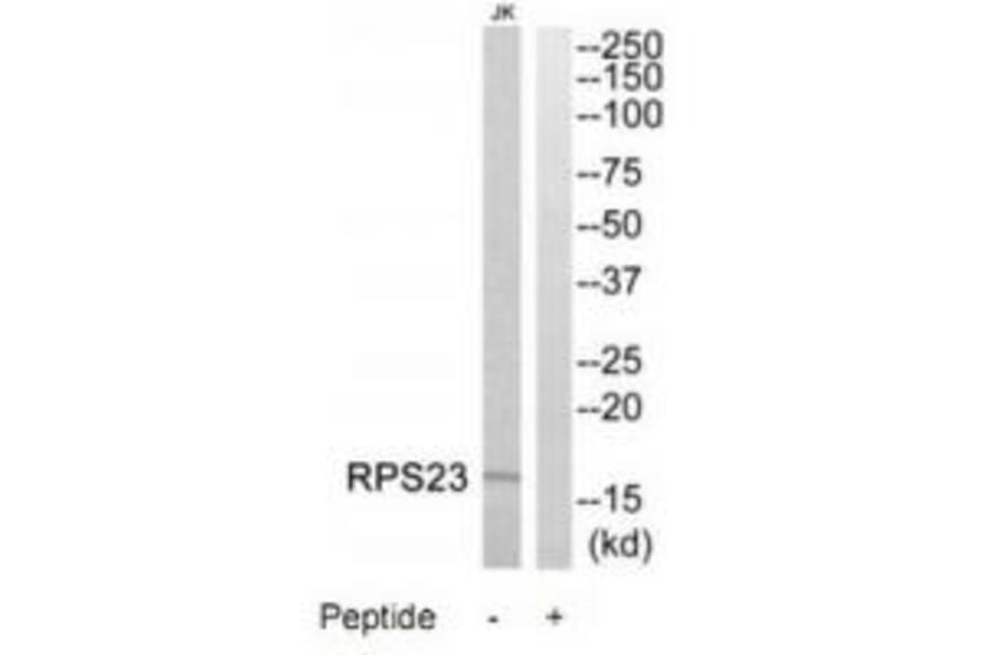 Western blot - RPS23 Antibody from Signalway Antibody (34336) - Antibodies.com