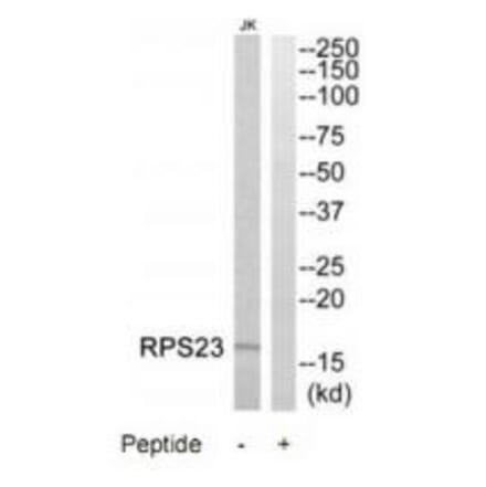 Western blot - RPS23 Antibody from Signalway Antibody (34336) - Antibodies.com