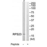 Western blot - RPS23 Antibody from Signalway Antibody (34336) - Antibodies.com