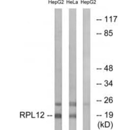 Western blot - RPL12 Antibody from Signalway Antibody (34346) - Antibodies.com