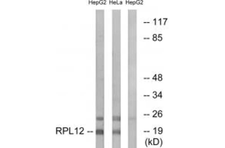 Western blot - RPL12 Antibody from Signalway Antibody (34346) - Antibodies.com