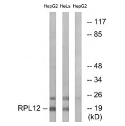 Western blot - RPL12 Antibody from Signalway Antibody (34346) - Antibodies.com