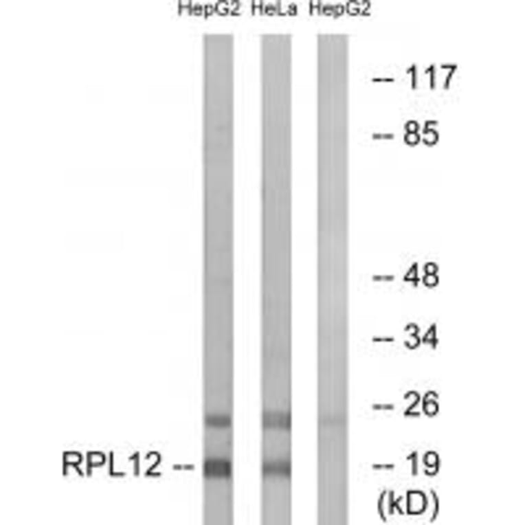 Western blot - RPL12 Antibody from Signalway Antibody (34346) - Antibodies.com