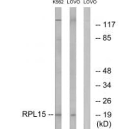 Western blot - RPL15 Antibody from Signalway Antibody (34348) - Antibodies.com