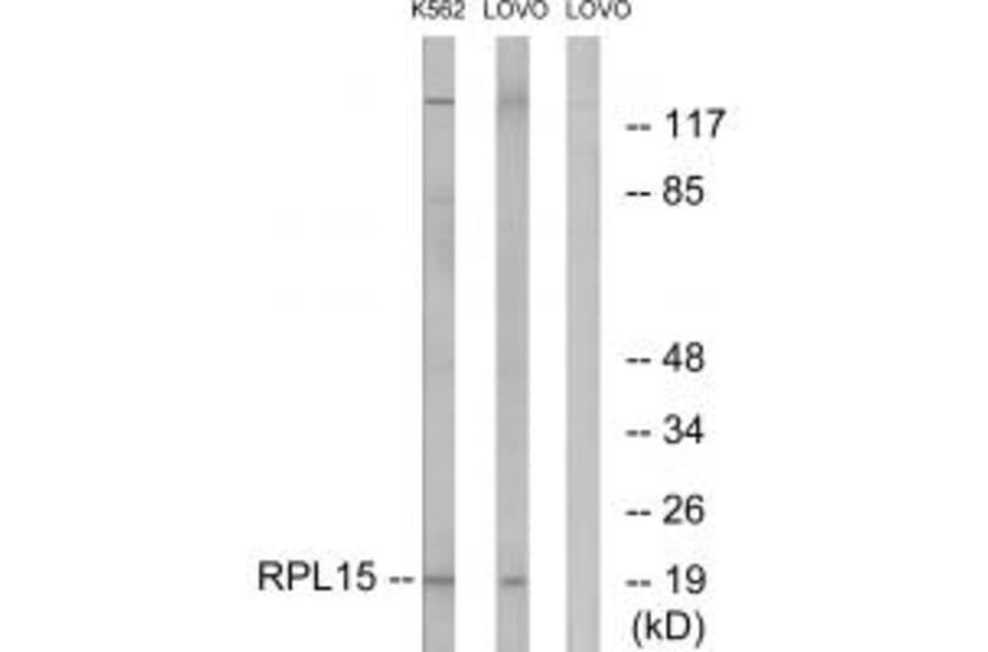 Western blot - RPL15 Antibody from Signalway Antibody (34348) - Antibodies.com