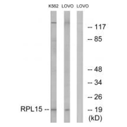 Western blot - RPL15 Antibody from Signalway Antibody (34348) - Antibodies.com