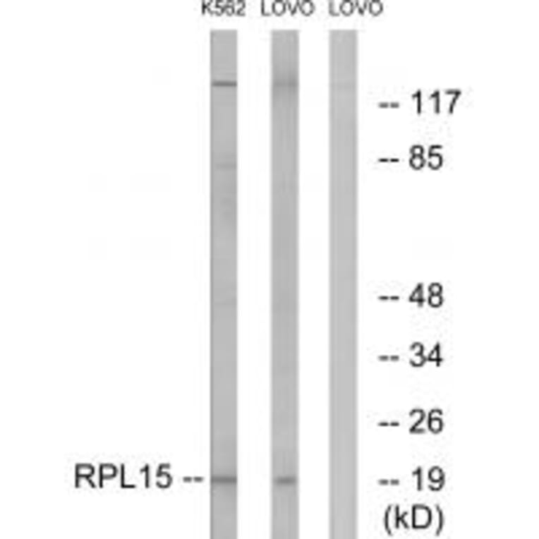 Western blot - RPL15 Antibody from Signalway Antibody (34348) - Antibodies.com