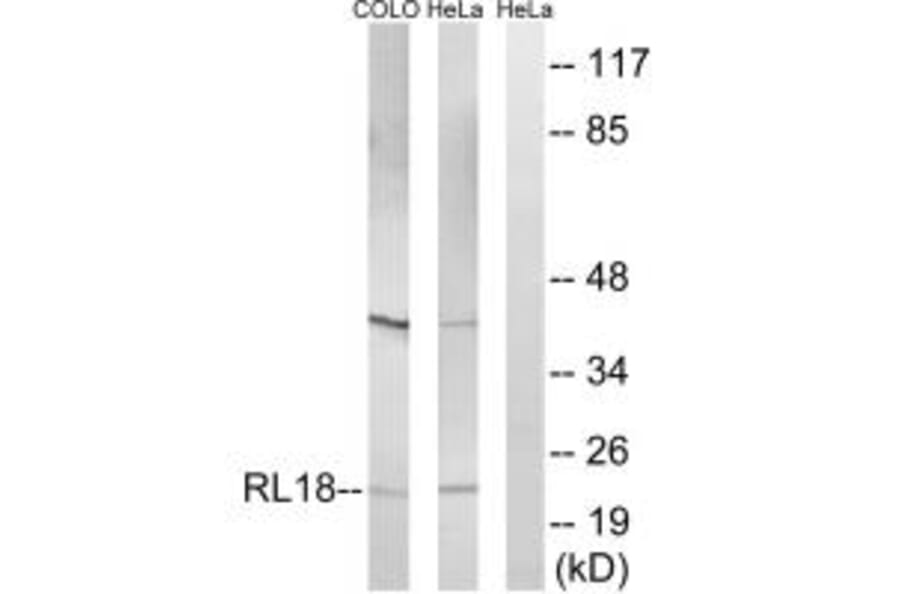 Western blot - RPL18 Antibody from Signalway Antibody (34349) - Antibodies.com