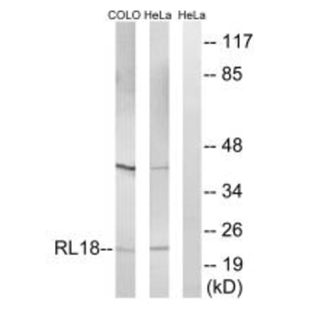 Western blot - RPL18 Antibody from Signalway Antibody (34349) - Antibodies.com