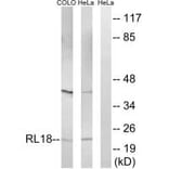 Western blot - RPL18 Antibody from Signalway Antibody (34349) - Antibodies.com