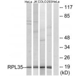 Western blot - RPL35 Antibody from Signalway Antibody (34357) - Antibodies.com
