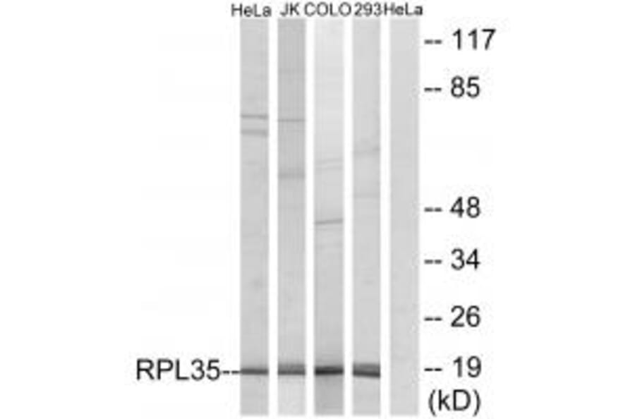 Western blot - RPL35 Antibody from Signalway Antibody (34357) - Antibodies.com