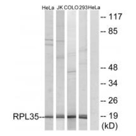 Western blot - RPL35 Antibody from Signalway Antibody (34357) - Antibodies.com