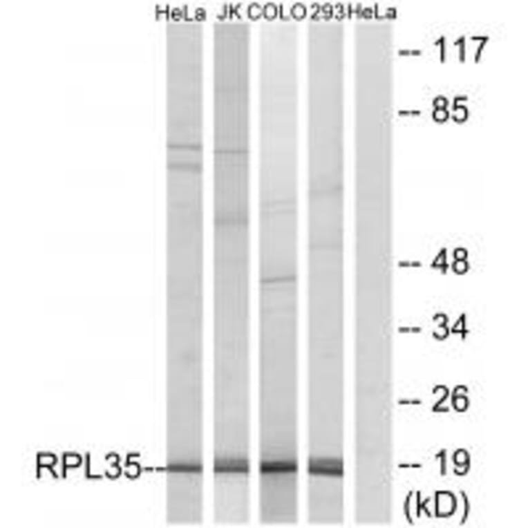 Western blot - RPL35 Antibody from Signalway Antibody (34357) - Antibodies.com