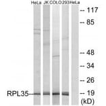 Western blot - RPL35 Antibody from Signalway Antibody (34357) - Antibodies.com