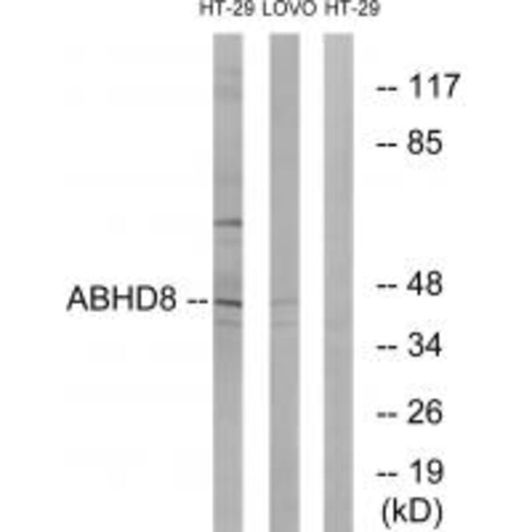 Western blot - ABHD8 Antibody from Signalway Antibody (34372) - Antibodies.com