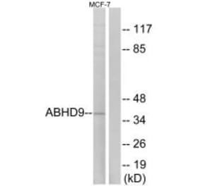 Western blot - ABHD9 Antibody from Signalway Antibody (34373) - Antibodies.com
