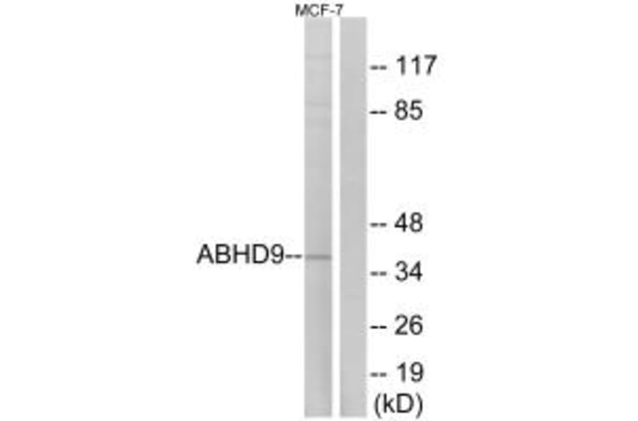 Western blot - ABHD9 Antibody from Signalway Antibody (34373) - Antibodies.com