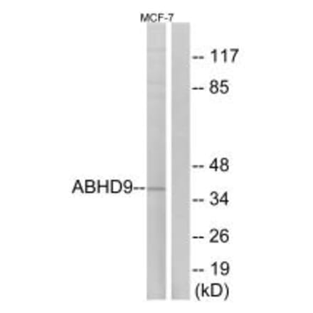 Western blot - ABHD9 Antibody from Signalway Antibody (34373) - Antibodies.com