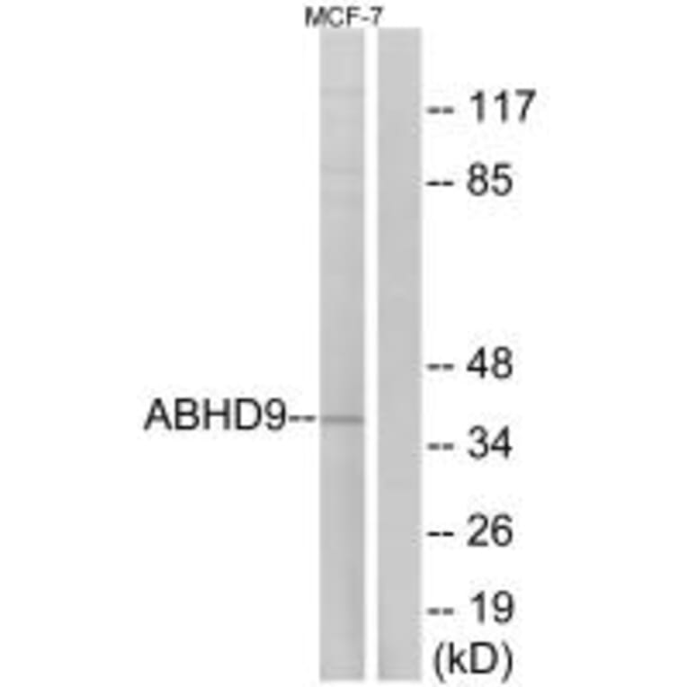 Western blot - ABHD9 Antibody from Signalway Antibody (34373) - Antibodies.com