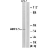Western blot - ABHD9 Antibody from Signalway Antibody (34373) - Antibodies.com