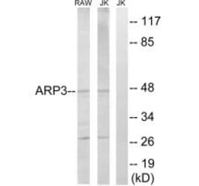 Western blot - ACTR3 Antibody from Signalway Antibody (34376) - Antibodies.com