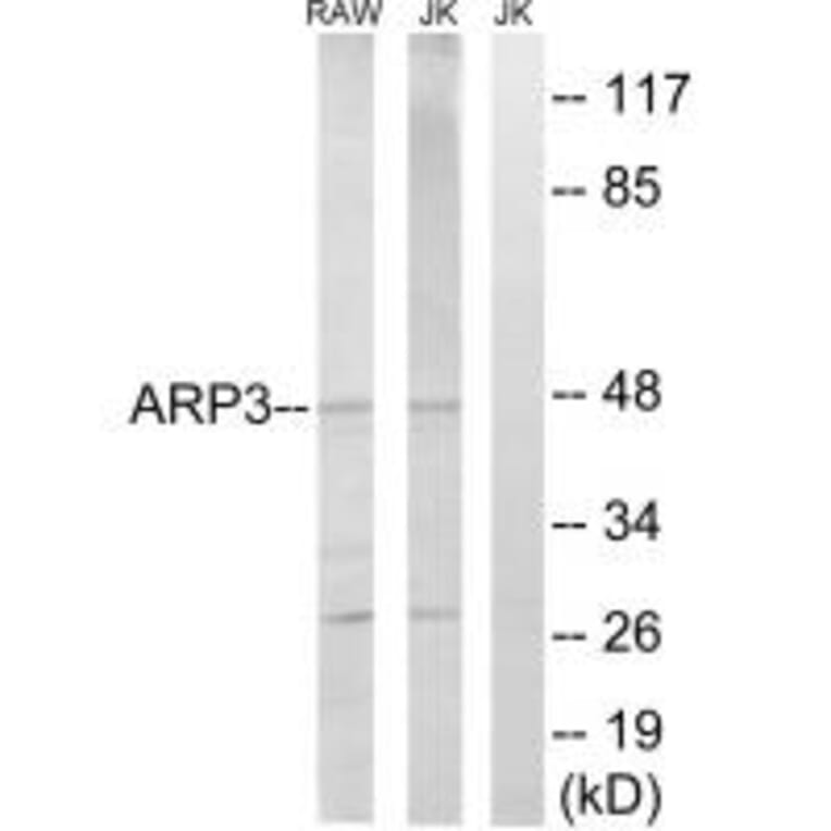 Western blot - ACTR3 Antibody from Signalway Antibody (34376) - Antibodies.com