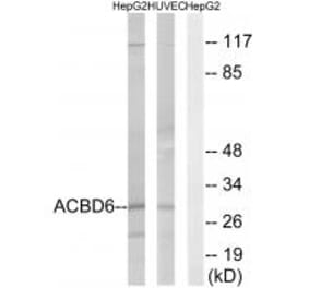 Western blot - ACBD6 Antibody from Signalway Antibody (34378) - Antibodies.com