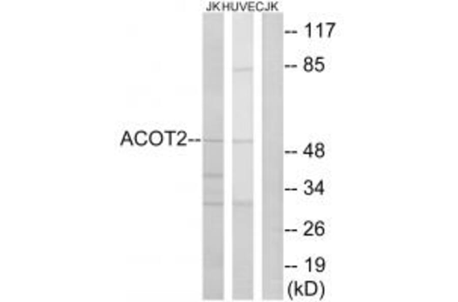 Western blot - ACOT2 Antibody from Signalway Antibody (34381) - Antibodies.com