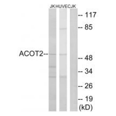 Western blot - ACOT2 Antibody from Signalway Antibody (34381) - Antibodies.com