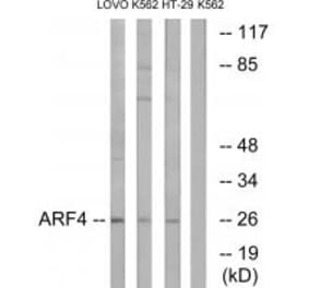 Western blot - ARF4 Antibody from Signalway Antibody (34391) - Antibodies.com