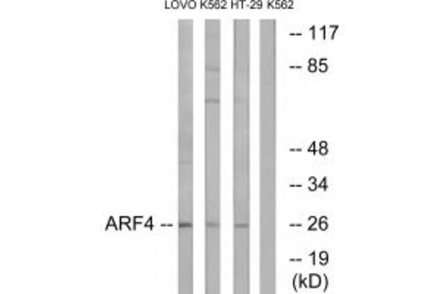 Western blot - ARF4 Antibody from Signalway Antibody (34391) - Antibodies.com