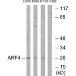 Western blot - ARF4 Antibody from Signalway Antibody (34391) - Antibodies.com
