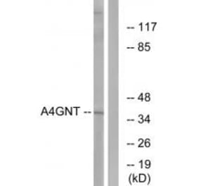 Western blot - A4GNT Antibody from Signalway Antibody (34406) - Antibodies.com