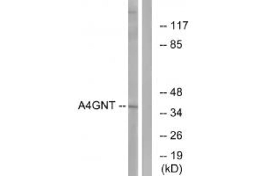 Western blot - A4GNT Antibody from Signalway Antibody (34406) - Antibodies.com