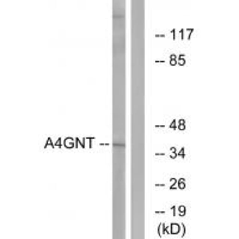 Western blot - A4GNT Antibody from Signalway Antibody (34406) - Antibodies.com