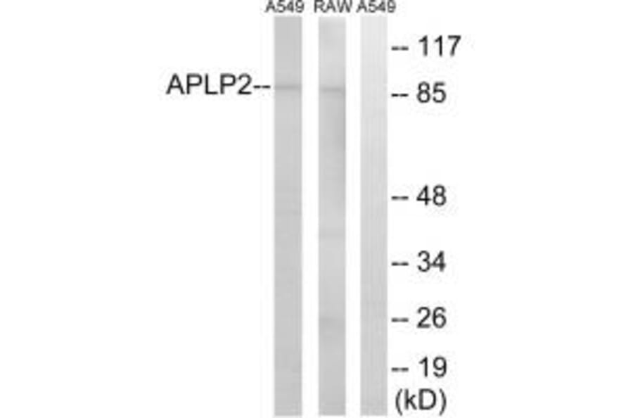 Western blot - APLP2 Antibody from Signalway Antibody (34415) - Antibodies.com
